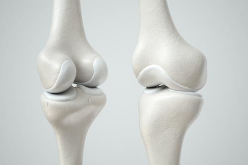 Bone
